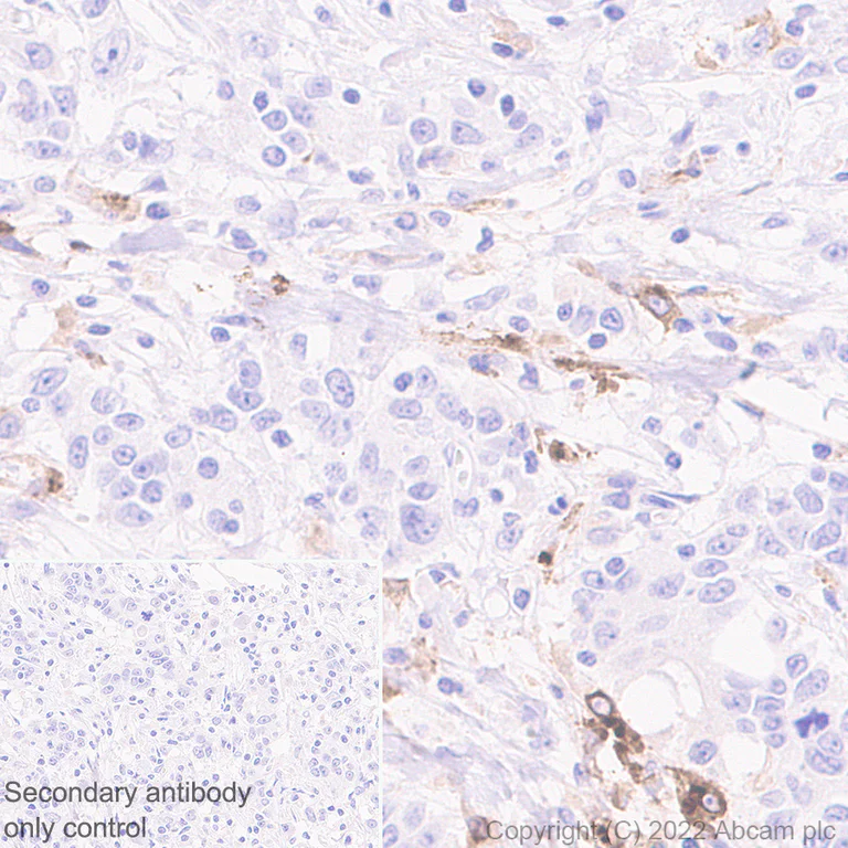 Immunohistochemistry (Formalin/PFA-fixed paraffin-embedded sections) - Anti-CCL18 antibody [EPR24781-84] (AB300057)