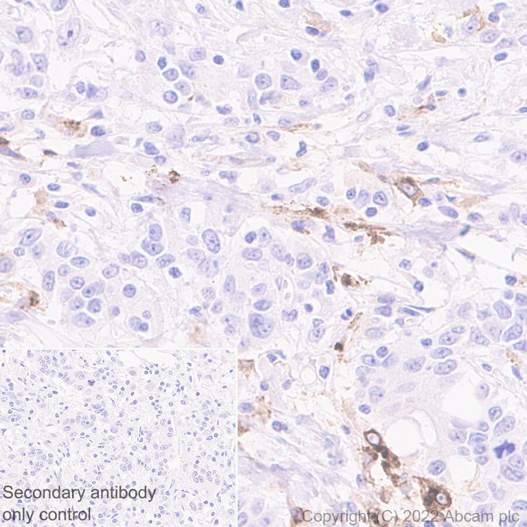 Immunohistochemistry (Formalin/PFA-fixed paraffin-embedded sections) - Anti-CCL18 antibody [EPR24781-84] (BSA and Azide free) (AB300058)
