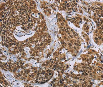 Immunohistochemistry (Formalin/PFA-fixed paraffin-embedded sections) - Anti-CCL21 antibody (AB197760)