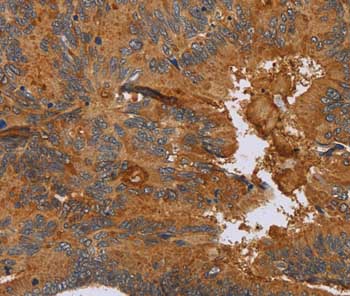 Immunohistochemistry (Formalin/PFA-fixed paraffin-embedded sections) - Anti-CCL21 antibody (AB197760)