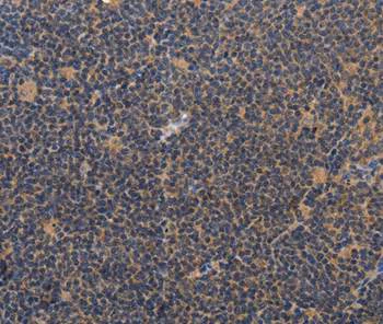 Immunohistochemistry (Formalin/PFA-fixed paraffin-embedded sections) - Anti-CCL23 antibody - C-terminal (AB199167)