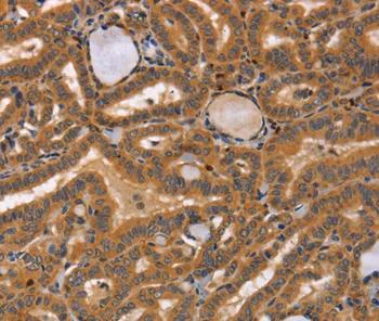 Immunohistochemistry (Formalin/PFA-fixed paraffin-embedded sections) - Anti-CCL23 antibody - C-terminal (AB199167)