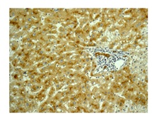 Immunohistochemistry (Formalin/PFA-fixed paraffin-embedded sections) - Anti-CCL23 antibody [EPR11363] (AB171751), expandable thumbnail