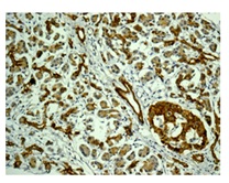 Immunohistochemistry (Formalin/PFA-fixed paraffin-embedded sections) - Anti-CCL23 antibody [EPR11363] (AB171751), expandable thumbnail