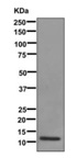 Western blot - Anti-CCL23 antibody [EPR11363] (AB171751), expandable thumbnail