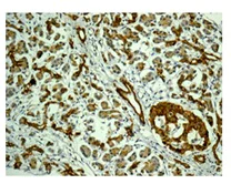 Immunohistochemistry (Formalin/PFA-fixed paraffin-embedded sections) - Anti-CCL23 antibody [EPR11363] - BSA and Azide free (AB249653)