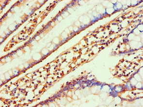 Immunohistochemistry (Formalin/PFA-fixed paraffin-embedded sections) - Anti-CCL25 antibody (AB238114)