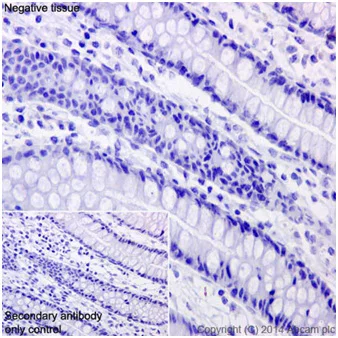 Immunohistochemistry (Formalin/PFA-fixed paraffin-embedded sections) - Anti-CCL25 antibody [EPR12388(2)] (AB200343)