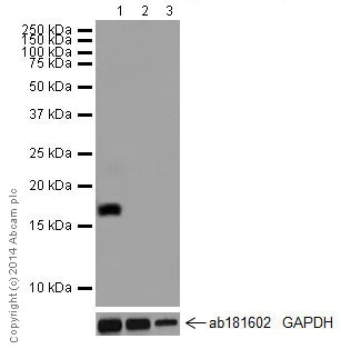 Western blot - Anti-CCL25 antibody [EPR12388(2)] (AB200343)