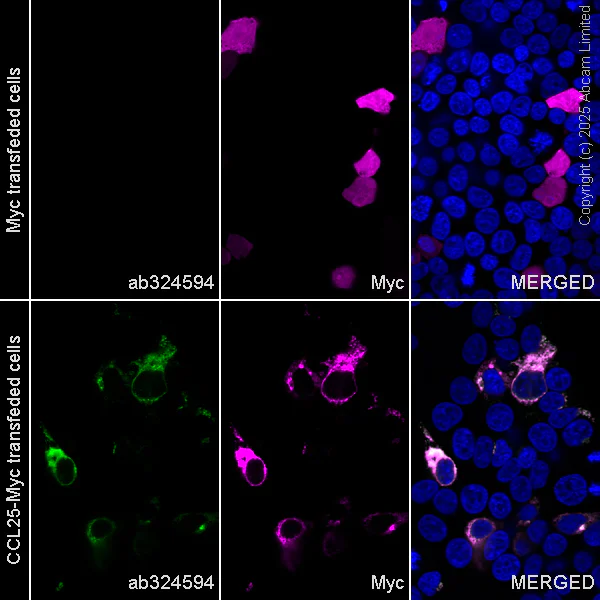 Immunocytochemistry/ Immunofluorescence - Anti-CCL25 antibody [EPR18002-133] (AB324594)