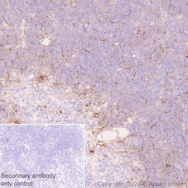 Immunohistochemistry (Formalin/PFA-fixed paraffin-embedded sections) - Anti-CCL25 antibody [EPR18002-133] (AB324594)