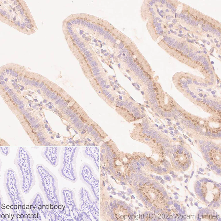Immunohistochemistry (Formalin/PFA-fixed paraffin-embedded sections) - Anti-CCL25 antibody [EPR18002-133] (AB324594)