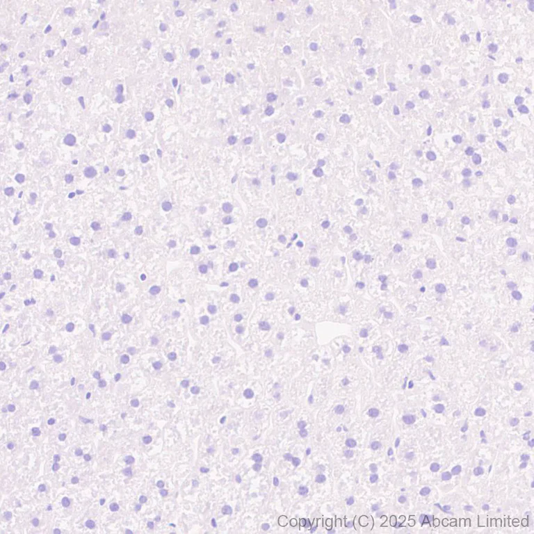 Immunohistochemistry (Formalin/PFA-fixed paraffin-embedded sections) - Anti-CCL25 antibody [EPR18002-133] (AB324594)