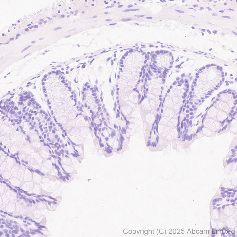 Immunohistochemistry (Formalin/PFA-fixed paraffin-embedded sections) - Anti-CCL25 antibody [EPR18002-133] (AB324594)