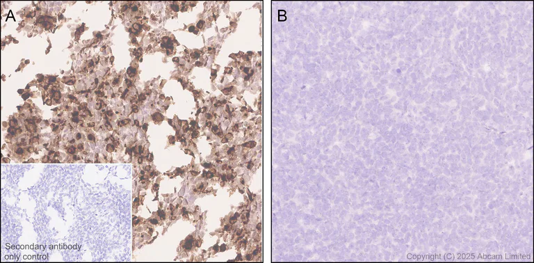 Immunohistochemistry (Formalin/PFA-fixed paraffin-embedded sections) - Anti-CCL25 antibody [EPR18002-133] (AB324594)