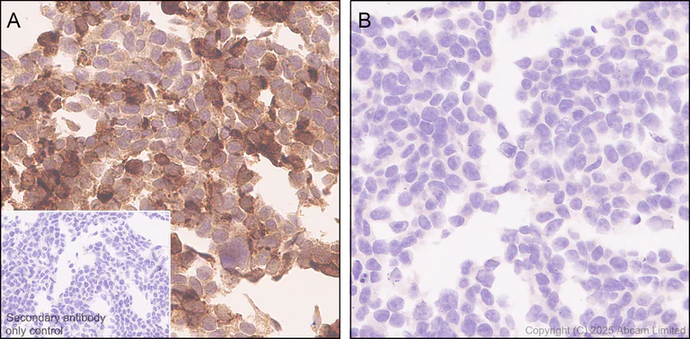 Immunohistochemistry (Formalin/PFA-fixed paraffin-embedded sections) - Anti-CCL27 antibody [EPR28944-181] (AB324973)