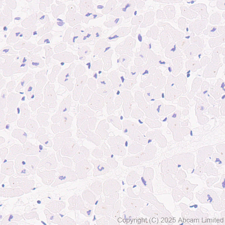 Immunohistochemistry (Formalin/PFA-fixed paraffin-embedded sections) - Anti-CCL27 antibody [EPR28944-181] (AB324973)