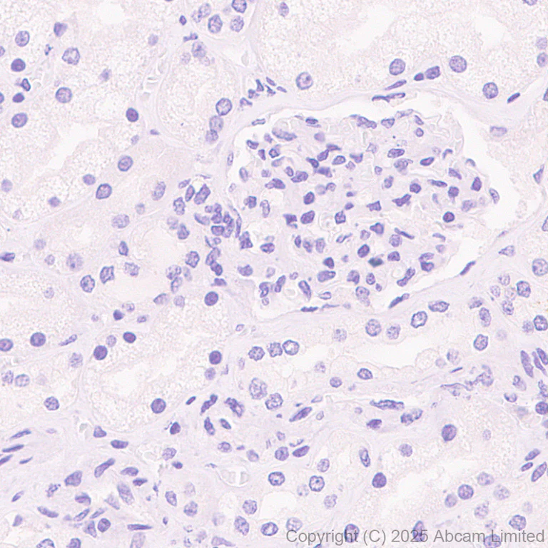 Immunohistochemistry (Formalin/PFA-fixed paraffin-embedded sections) - Anti-CCL27 antibody [EPR28944-181] (AB324973)
