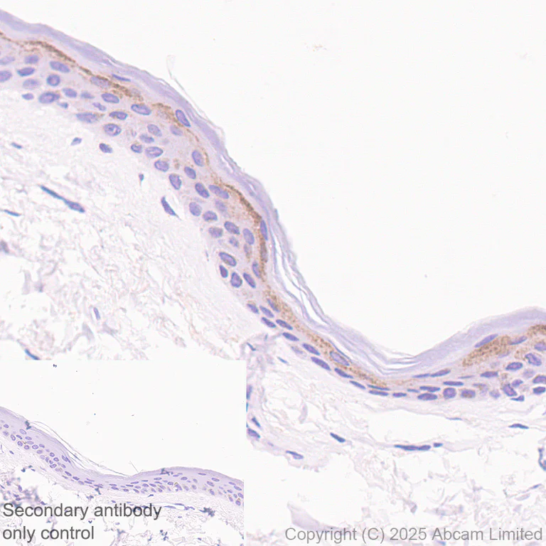 Immunohistochemistry (Formalin/PFA-fixed paraffin-embedded sections) - Anti-CCL27 antibody [EPR28944-181] (AB324973)