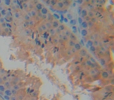 Immunohistochemistry (Formalin/PFA-fixed paraffin-embedded sections) - Anti-CCL28/MEC antibody (AB231557)