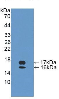 Western blot - Anti-CCL28/MEC antibody (AB232837), expandable thumbnail