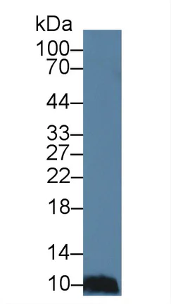 Western blot - Anti-CCL28/MEC antibody (AB232837)