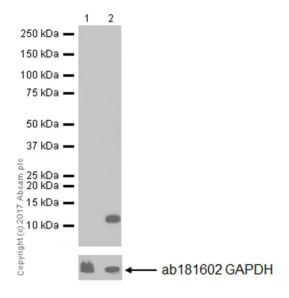 Western blot - Anti-CCL3 / MIP-1 alpha antibody [EPR16618-90] (AB179638)