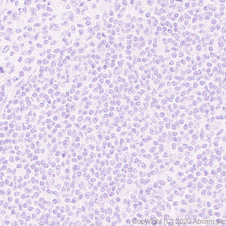 Immunohistochemistry (Formalin/PFA-fixed paraffin-embedded sections) - Anti-CCL3 / MIP-1 alpha + CCL3L1 antibody [EPR23751-54] (AB259372)