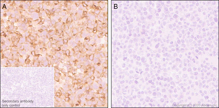 Immunohistochemistry (Formalin/PFA-fixed paraffin-embedded sections) - Anti-CCL3 / MIP-1 alpha + CCL3L1 antibody [EPR23751-54] - BSA and Azide (AB277944)