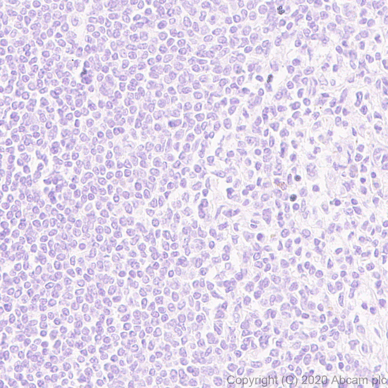 Immunohistochemistry (Formalin/PFA-fixed paraffin-embedded sections) - Anti-CCL3 / MIP-1 alpha + CCL3L1 antibody [EPR23751-54] - BSA and Azide (AB277944)
