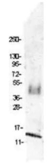 Western blot - Anti-CCL4/MIP-1 beta antibody (AB106548)
