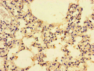 Immunohistochemistry (Formalin/PFA-fixed paraffin-embedded sections) - Anti-CCL4/MIP-1 beta antibody (AB235961)