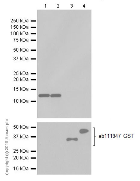 Western blot - Anti-CCL4/MIP-1 beta antibody [EP521Y] (AB45690), expandable thumbnail
