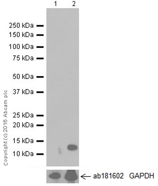 Western blot - Anti-CCL4/MIP-1 beta antibody [EP521Y] (ab45690), expandable thumbnail