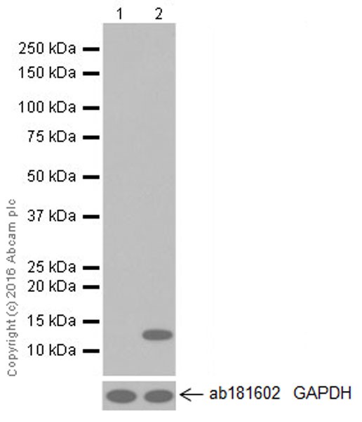 Western blot - Anti-CCL4/MIP-1 beta antibody [EP521Y] (AB45690), expandable thumbnail