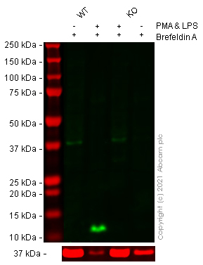 Western blot - Anti-CCL4/MIP-1 beta antibody [EP521Y] (AB45690), expandable thumbnail