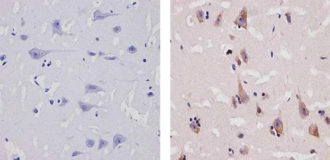 Immunohistochemistry paraffin embedded sections - Anti-CCL4/MIP-1 beta antibody [RP23040078] (AB308044)