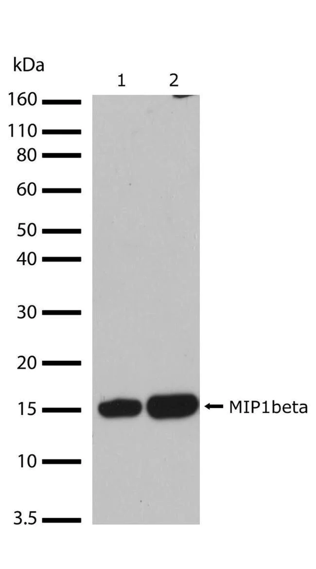 Western blot - Anti-CCL4/MIP-1 beta antibody [RP23040078] (AB308044)