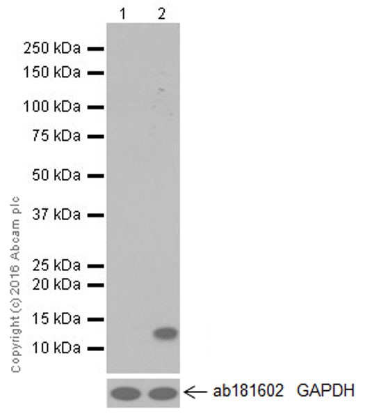 Western blot - Anti-CCL4/MIP-1 beta + CCL4L1 antibody [EPR494] (AB40857), expandable thumbnail