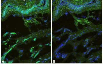 Immunocytochemistry/ Immunofluorescence - Anti-CCM2 antibody (AB129386)