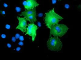Immunocytochemistry/ Immunofluorescence - Anti-CCM2 antibody [OTI2E4] (AB123930)
