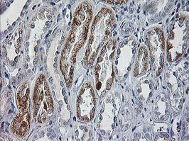 Immunohistochemistry (Formalin/PFA-fixed paraffin-embedded sections) - Anti-CCM2 antibody [OTI2E4] (AB123930)