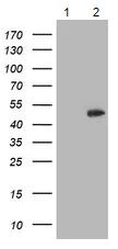 Western blot - Anti-CCM2 antibody [OTI2E4] (AB123930)