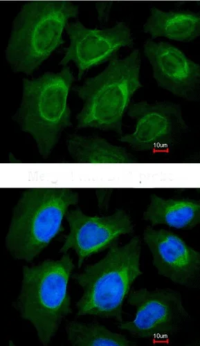 Immunocytochemistry/ Immunofluorescence - Anti-CCN3 antibody (AB137677)
