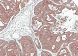Immunohistochemistry (Formalin/PFA-fixed paraffin-embedded sections) - Anti-CCN3 antibody (AB137677)