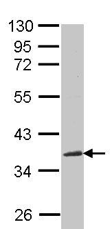 Anti-CCN3 antibody