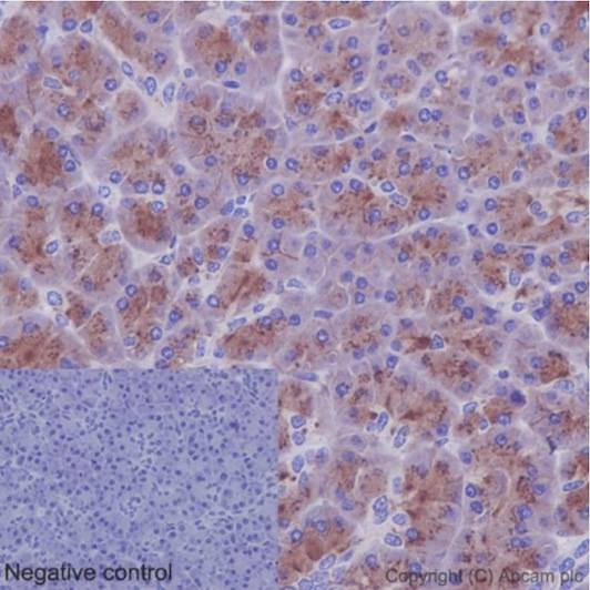 Immunohistochemistry (Formalin/PFA-fixed paraffin-embedded sections) - Anti-CCN3 antibody [EPR8781(3)] (AB191425)