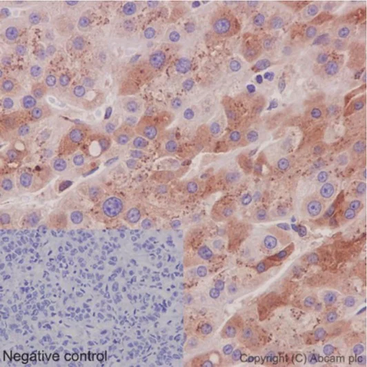 Immunohistochemistry (Formalin/PFA-fixed paraffin-embedded sections) - Anti-CCN3 antibody [EPR8781(3)] - BSA and Azide free (AB251077)