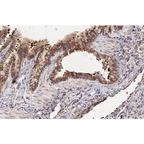 Immunohistochemistry (Formalin/PFA-fixed paraffin-embedded sections) - Anti-CCN3 antibody [HL2416] (AB317219)