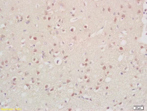 Immunohistochemistry (Formalin/PFA-fixed paraffin-embedded sections) - Anti-CCNG2 antibody (AB203314)